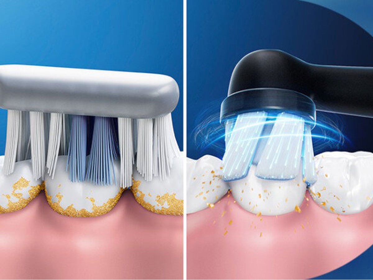 Szczoteczka magnetyczna Oral-B iO Series 2